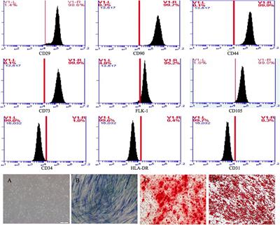 Preliminary study on mesenchymal stem cells in repairing nerve injury in pelvic floor denervation